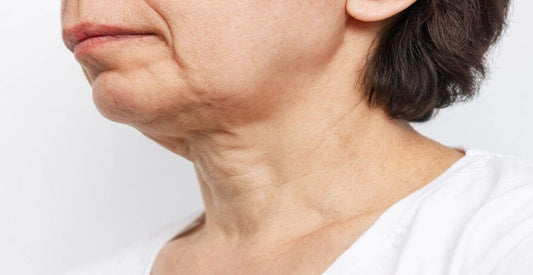 how to get rid of saggy neck