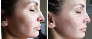 Brighter Skin