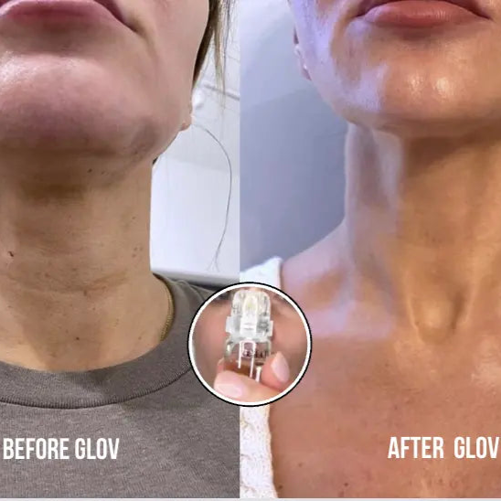 2 Glov Micro Infusion System + 6 Serums (TEST BUY BOX) Glov Beauty
