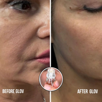 4 Glov Micro Infusion System + 12 Serums + 8 Needles