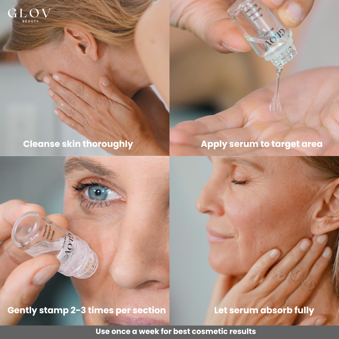 Glov Micro Infusion System