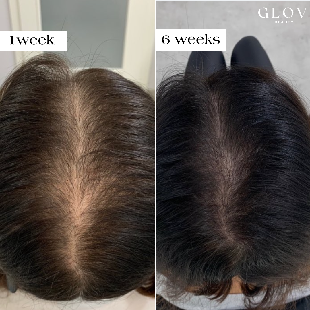 Hair Regrowth Bundle