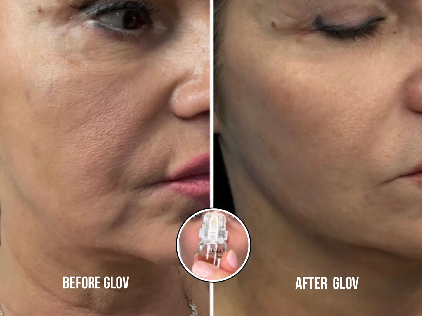 Glov Micro Infusion System - Glov Beauty
