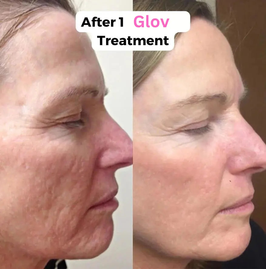 Glov Micro Infusion System Glov Beauty
