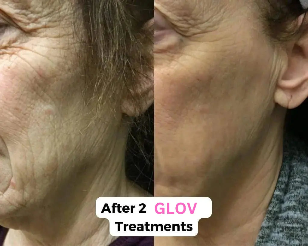 Glov Micro Infusion System Glov Beauty