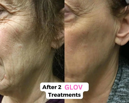 Glov Micro Infusion System Glov Beauty