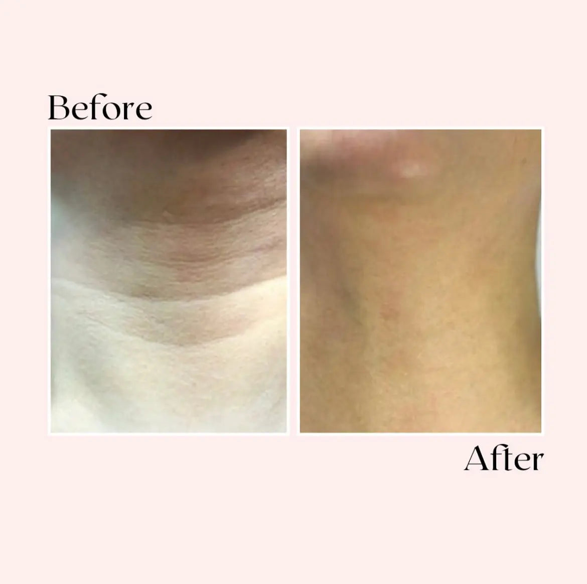 Glov Micro Infusion System Glov Beauty