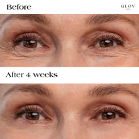 Glov Serum-Infused Microneedle Eye Patches