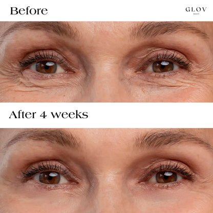 Eye Rejuvenation Bundle