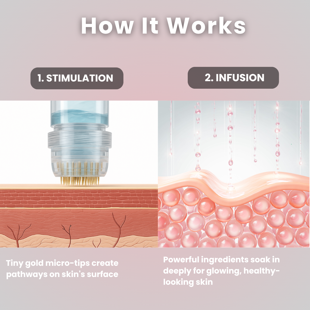 Glov Micro Infusion System