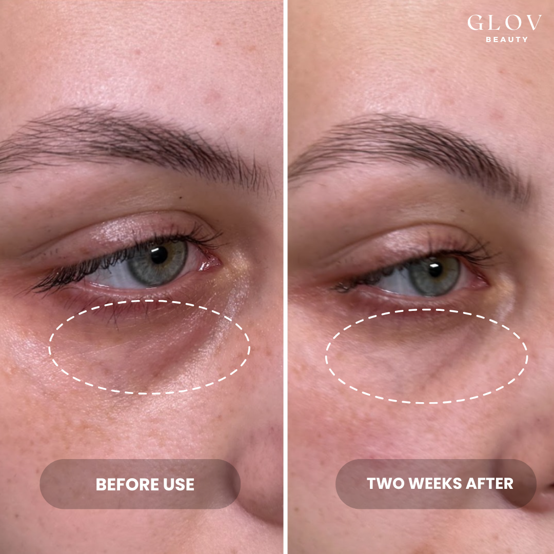 Eye Rejuvenation Bundle