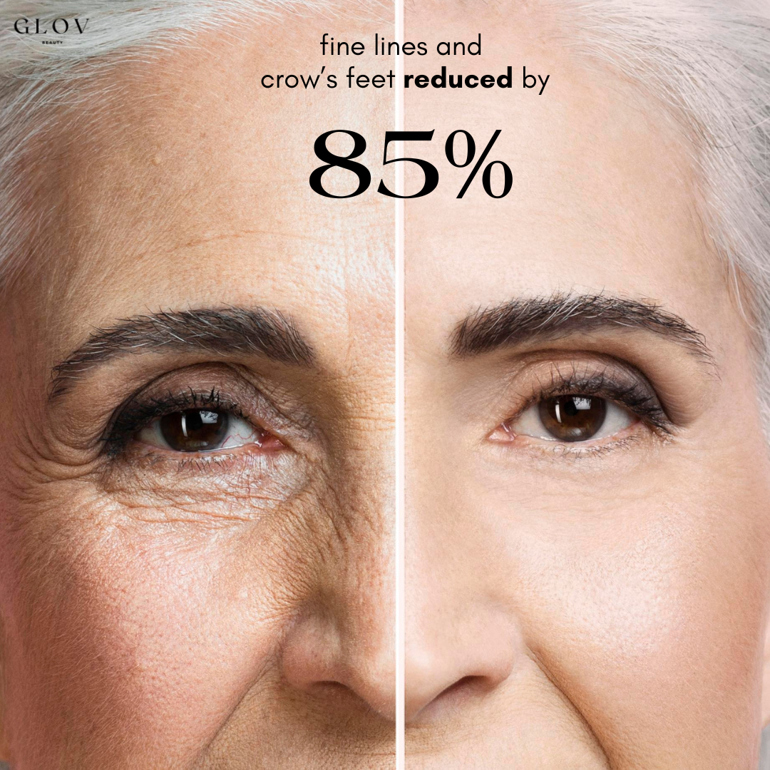 Eye Rejuvenation Bundle