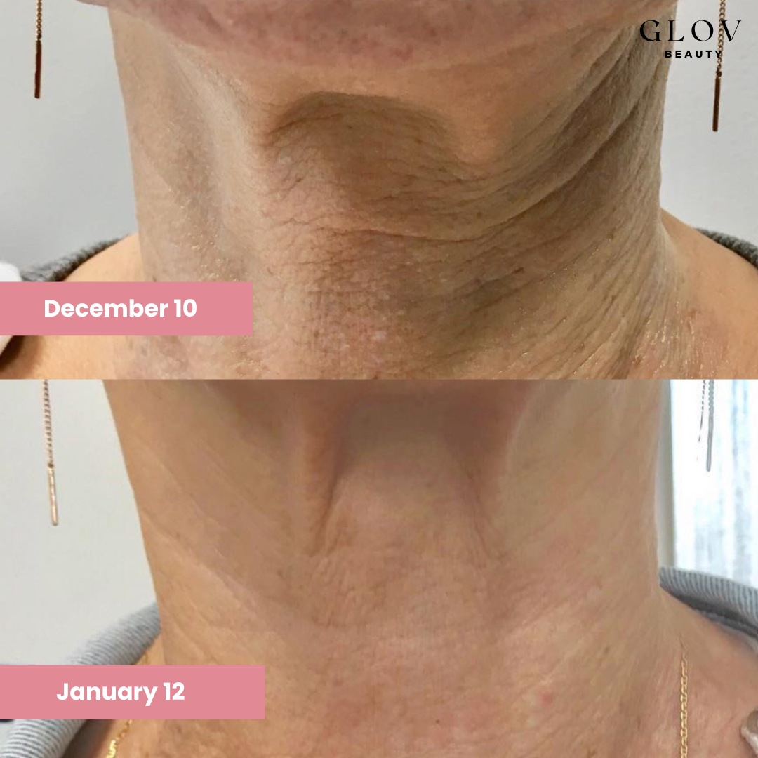 Smoothing & Firming Bundle